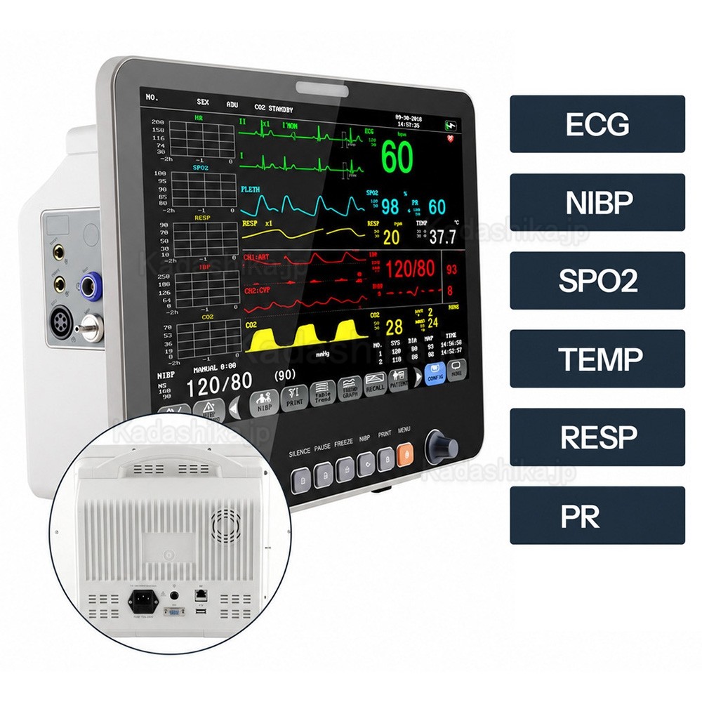 15.6インチ マルチパラメータ生体情報モニタ（ECG、NIBP、RESP、TEMP、SpO2、PR）