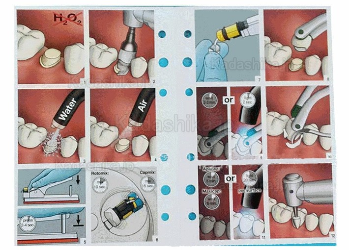 歯科カプセルアクチベーター＋注入器（ディスペンサー）(3M，GC富士カプセルなど)