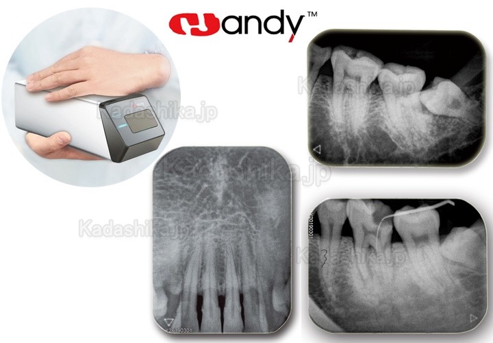 Handy HDS-500 歯科デジタルイメージングプレートスキャナー