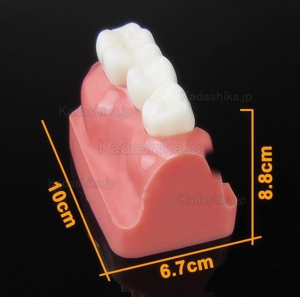 JX®M2017 歯科インプラント・クラウン歯模型