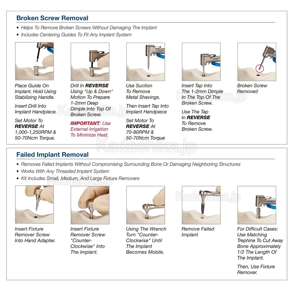 インプラントフィクスチャー＆スクリュー除去マスターキット MCT FSRK-02 ドリルガイドリムーバー