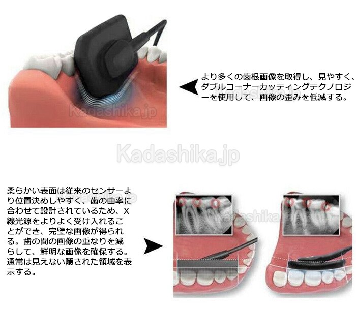 歯科用デジタルx線センサー CCDセンサー