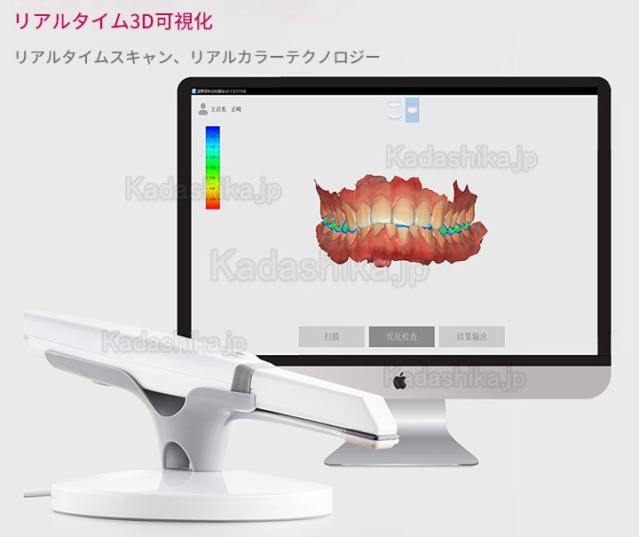 Runyes 3DS 歯科 口腔内スキャナー 3dスキャナー パウダーレスリアルカラースキャン