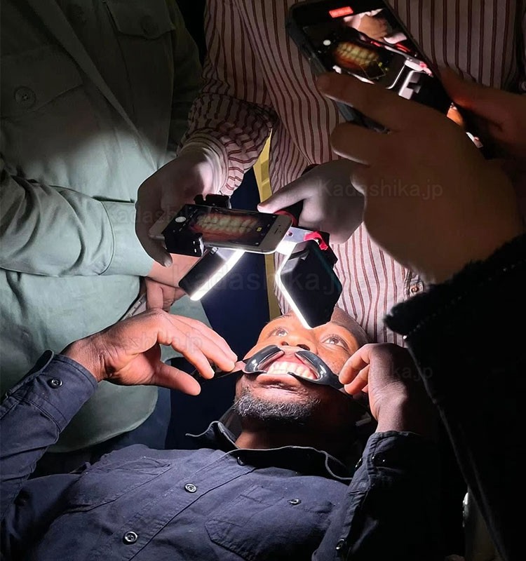 歯科調整口腔写真撮影 フラッシュライト 携帯電話歯科撮影用補助光